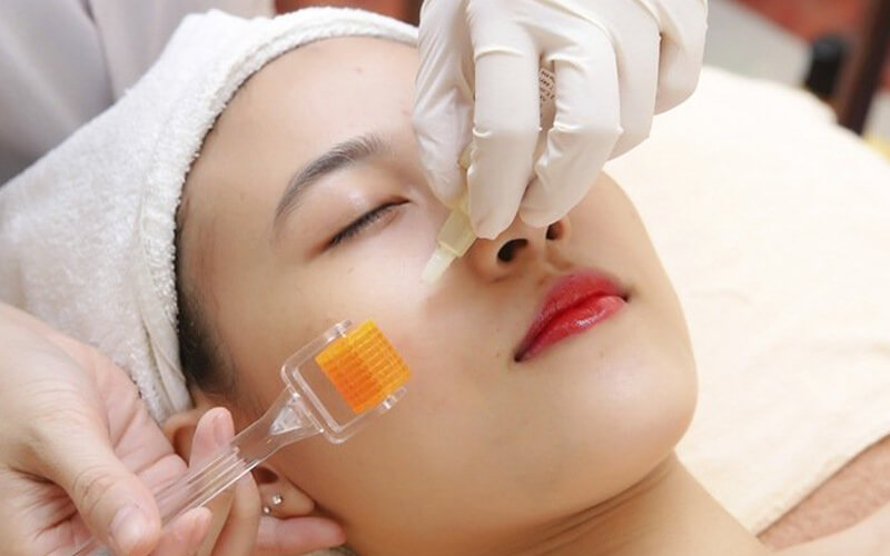 Hình ảnh người phụ nữ dử dụng phương pháp Tế bào gốc trị mụn ở dạng lỏng 